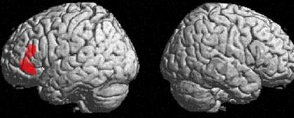 Science Magazine photos of two brains