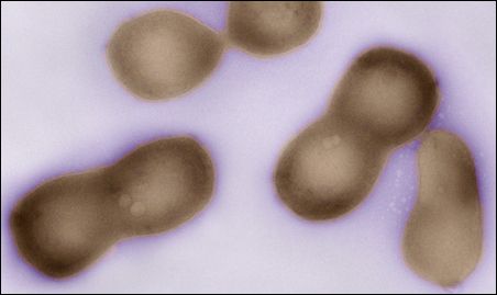 Source: J. Craig Venter Institute Negatively stained transmission electron micrographs of dividing Mycoplasma mycoides JCVI-syn1, a synthesized bacterial genome.